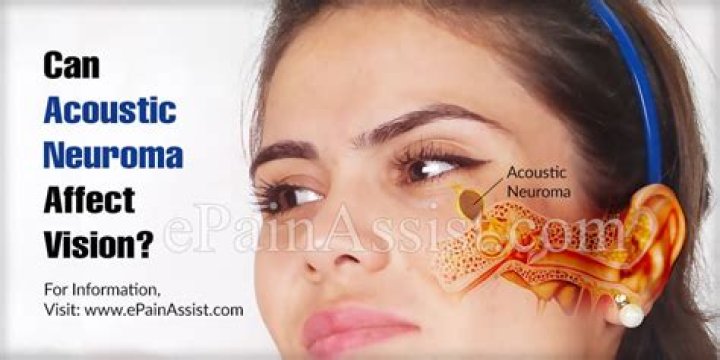 Can acoustic neuroma affect vision?