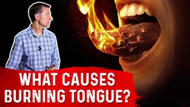 Can burning tongue go away?