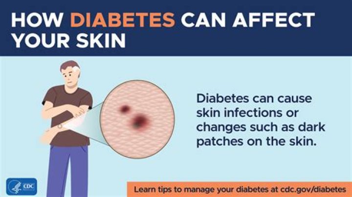 Can nausea be a sign of diabetes?