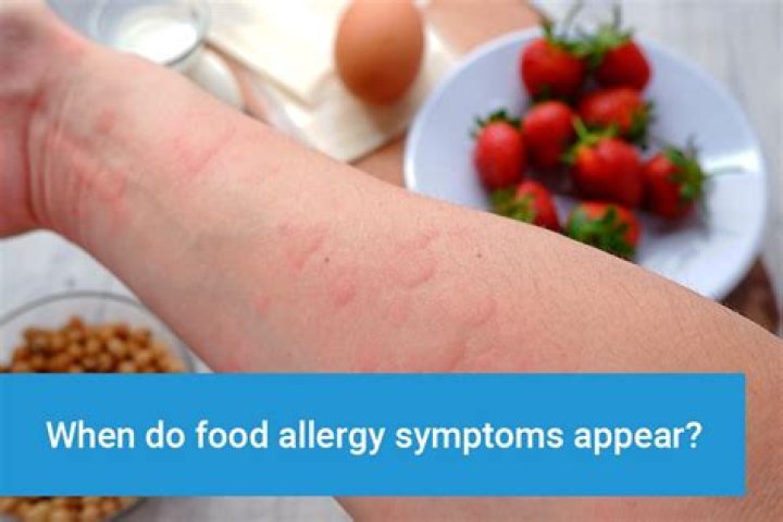 Can you be allergic to goji berries?