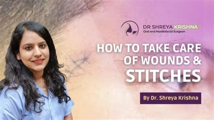 Can you still get stitches after 24 hours?