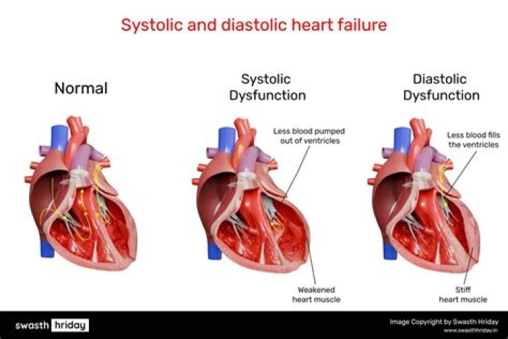 Does alcohol affect systolic or diastolic?