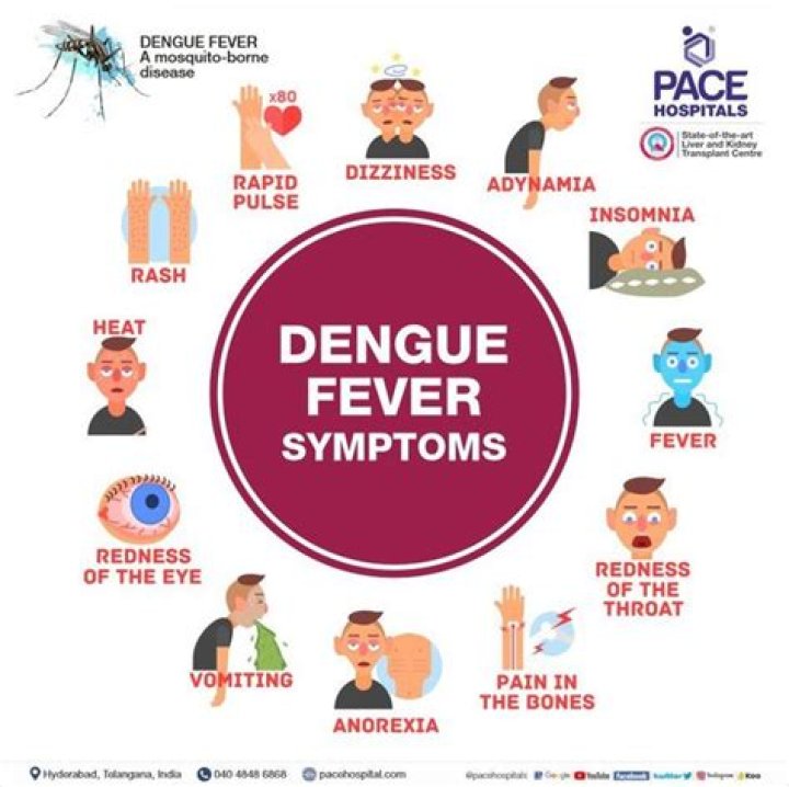 Does dengue fever cause itching?