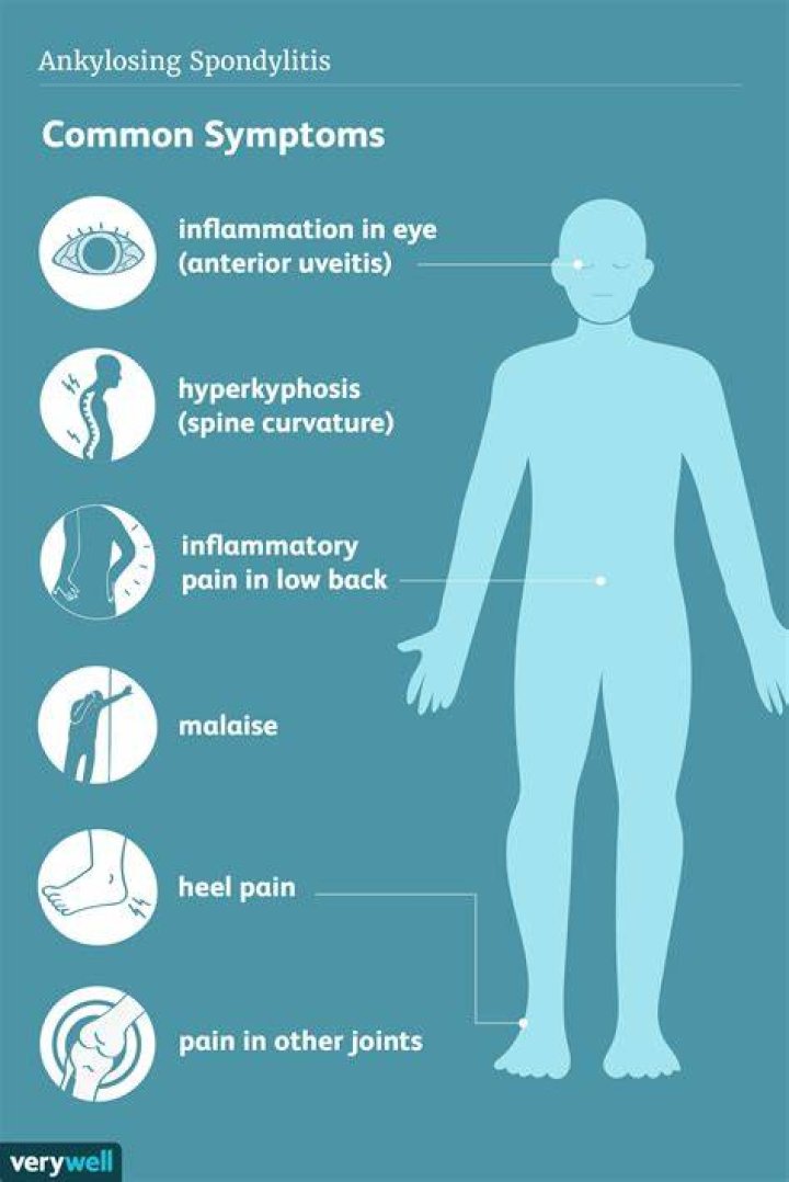 Does the weather affect ankylosing spondylitis?