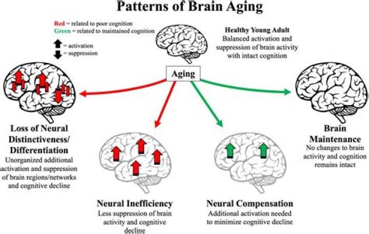 How can I stop my brain from aging?