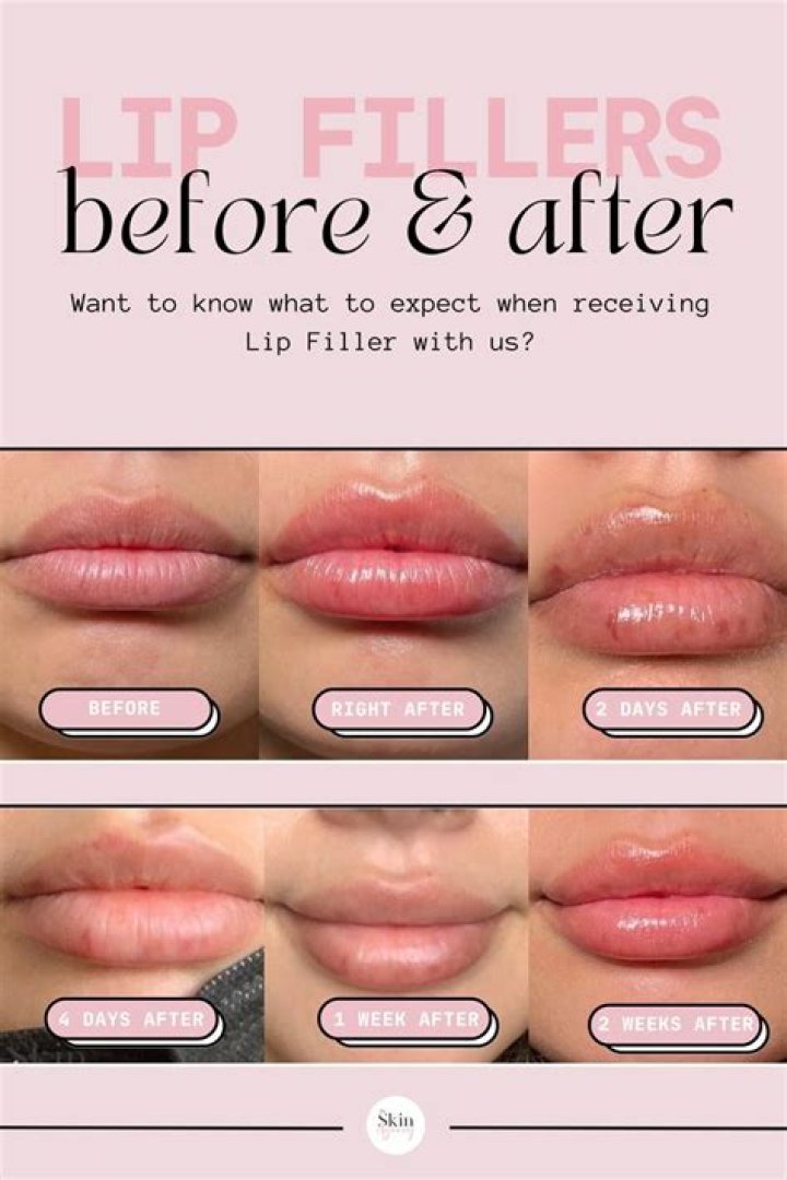 How do you get lip gloss off your skin?