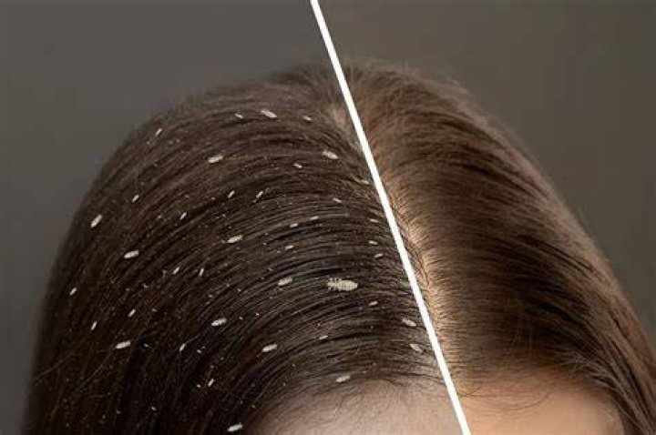 How do you get rid of lice on pigs?