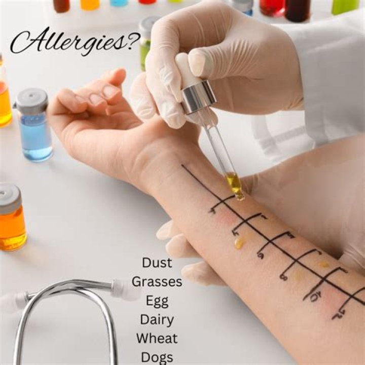 How do you test for dairy allergy?