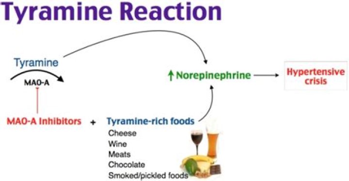 How does tyramine cause hypertensive crisis?