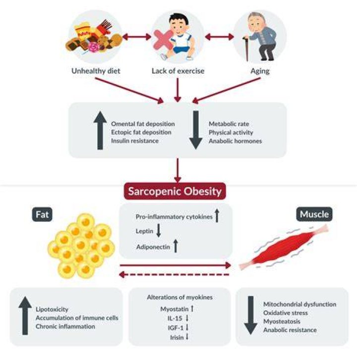 How is Sarcopenic obesity treated?