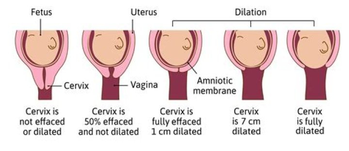How long can you be 4 cm dilated before going into labor?