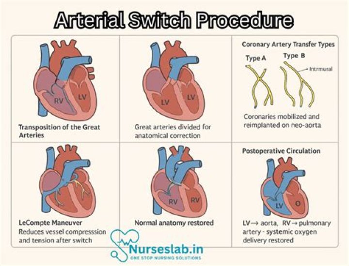 How long does arterial switch procedure take?