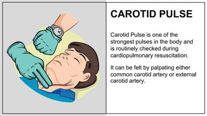 Is carotid pulse visible?