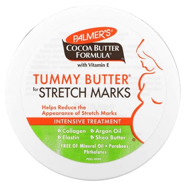 Is Cocoa Butter for Stretch Marks Good?