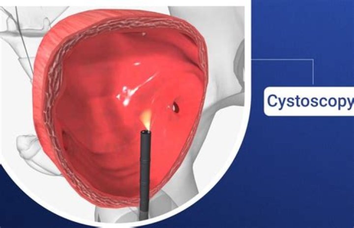 Is cystoscopy clean or sterile procedure?