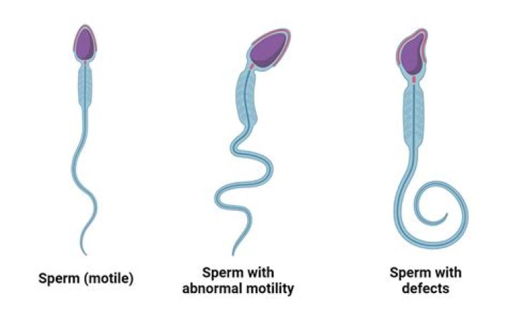 Is sperm stored in the epididymis?