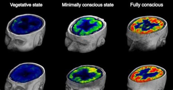 Is there brain activity in a vegetative state?
