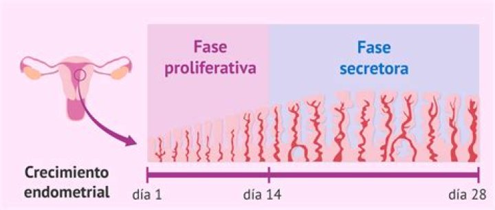 ¿Qué es un endometrio proliferativo?