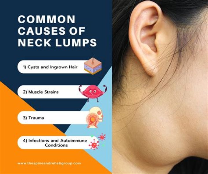 What causes your neck to lock up?