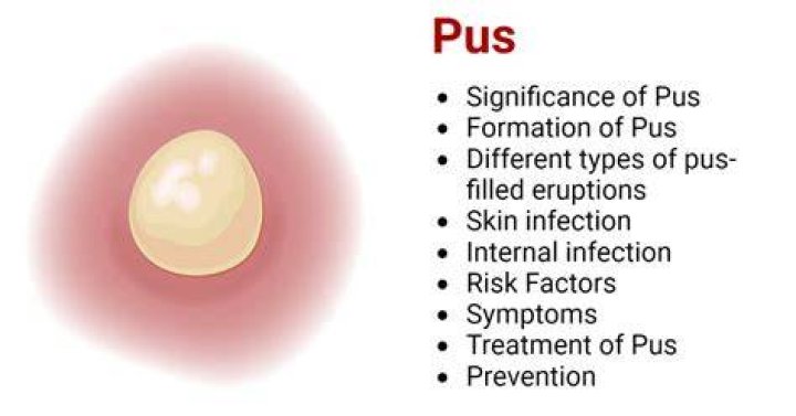 What cells make up pus?