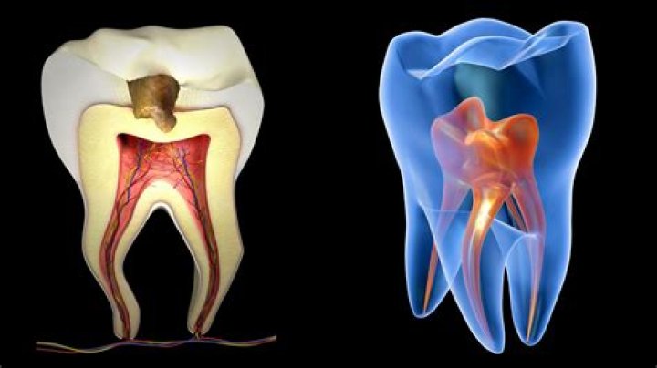 What does an endodontist do?
