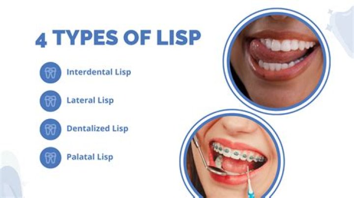 What does it mean if you have a lisp?