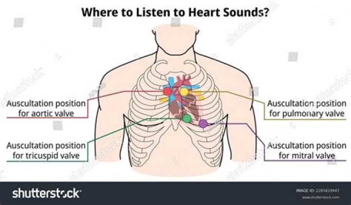 What does wheezing on auscultation mean?