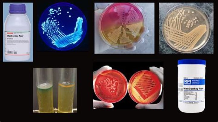 What is API in microbiology?