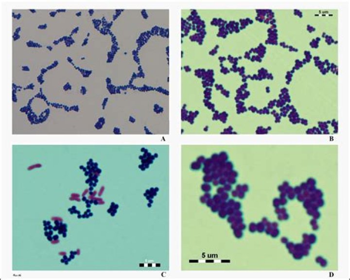 What is the morphology and arrangement of Staphylococcus aureus?