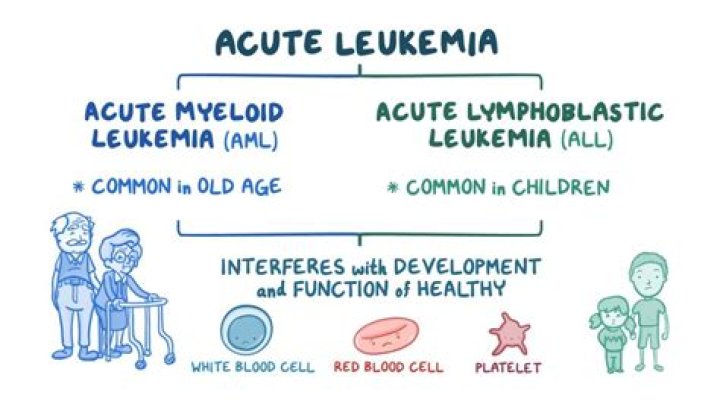 What is the most common age for childhood leukemia?