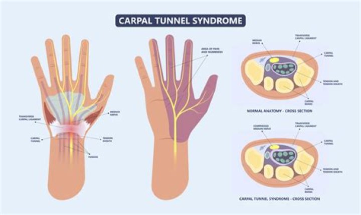 What passes through the carpal tunnel?