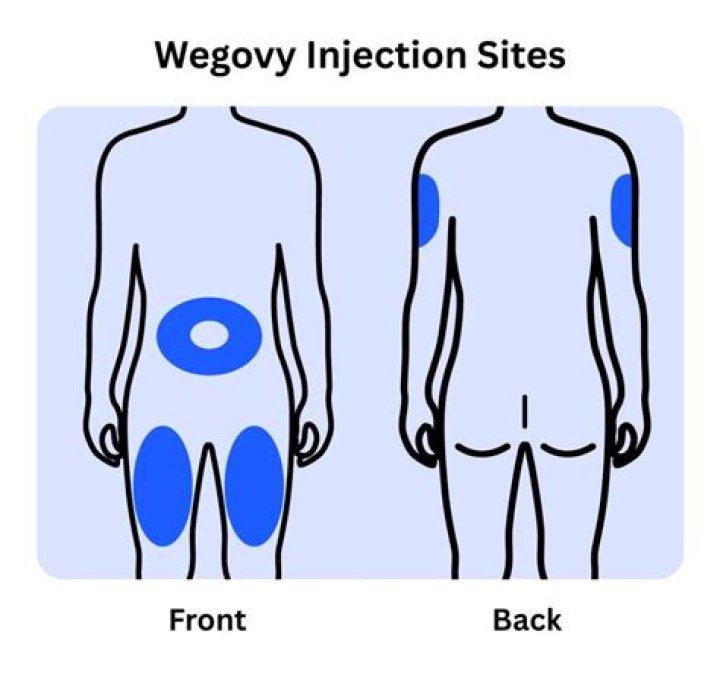 Where do you inject etanercept?