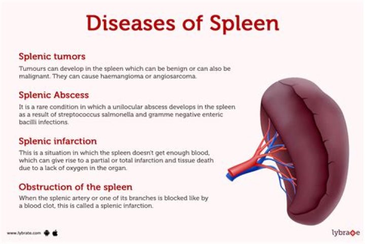 Where is the 6 point spleen?
