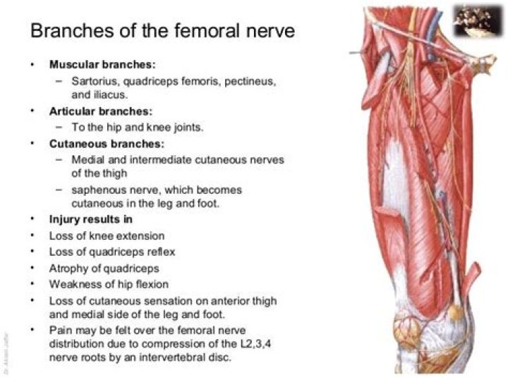 Which muscle or muscle group is served by the femoral nerve?
