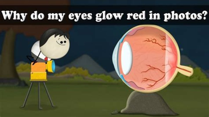 Why do my eyes glow in every picture?