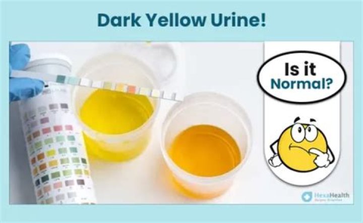 Why is my urine yellow in the morning?