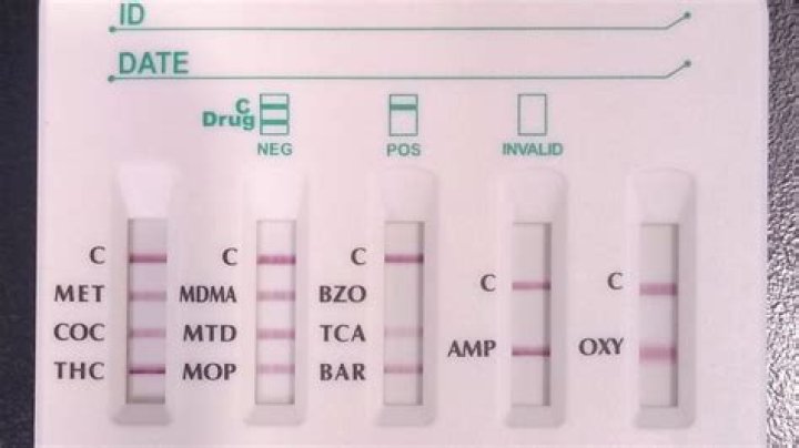 Will vitamin B show up on a drug test?